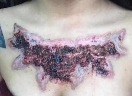 El #infierno que vivió una joven tailandesa después de intentar quitarse un #tatuaje #Tatoo (FOTOS)