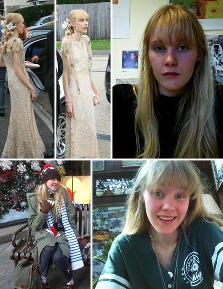 Impresionante: 20 personas que lograron superar la anorexia