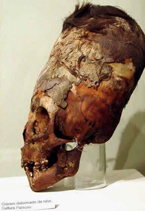 Uno de los cráneos alargados descubiertos cerca, en la península de Paracas