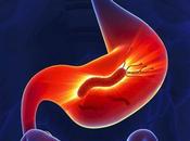 tiene Helicobacter pylori úlcera péptica