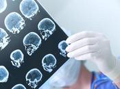 Epilepsia lóbulo temporal: diagnóstico tratamiento