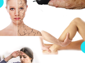 Además dolor inflamación articulaciones ¿existen síntomas artritis?