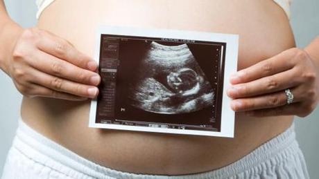 NO DERECHO AL NIÑO. SÍ A LOS DERECHOS DEL NIÑO