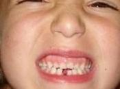 Como cuidar dientes niños