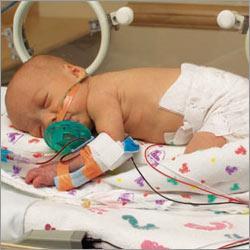 baby 4.000 niños con anomalías en el corazón nacen cada año en España