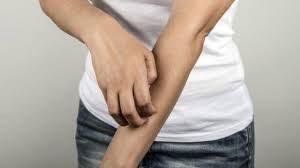 El significado de soñar con rascarse. El significado de soñar con rascarse.