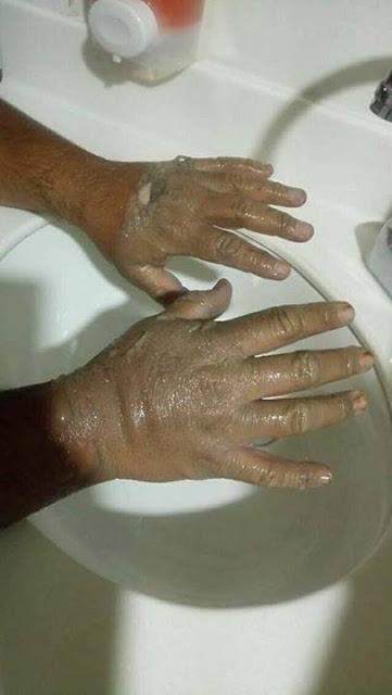 MANOS QUEMADAS, RESUMEN DE NOTICIAS EN ACERVO MEXIQUENSE