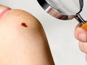 ¿Debe usted preocuparse lunar creciente?