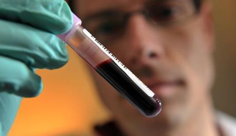 Una prueba para detectar cáncer en la sangre aspira a salvar millones de vidas