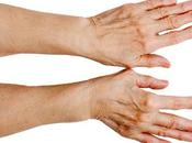 Tratamiento para manos veinales
