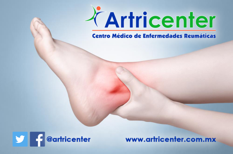 Artritis del pie y el tobillo