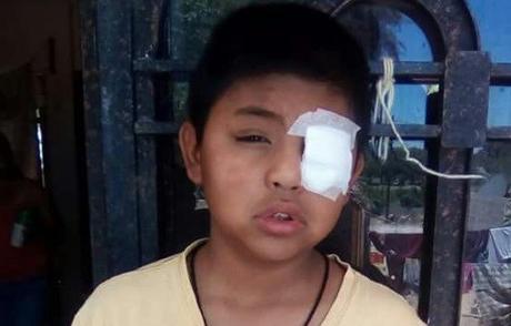 Piden apoyo para que niño no pierda la vista