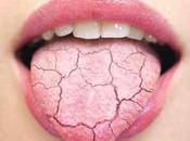 Sequedad severa boca después terapia cáncer: remedios médicos caseros