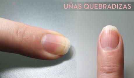 remedio para uñas rotas y quebradizas