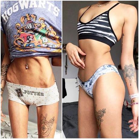 Mira estas 5 hermosas mujeres que superaron la anorexia