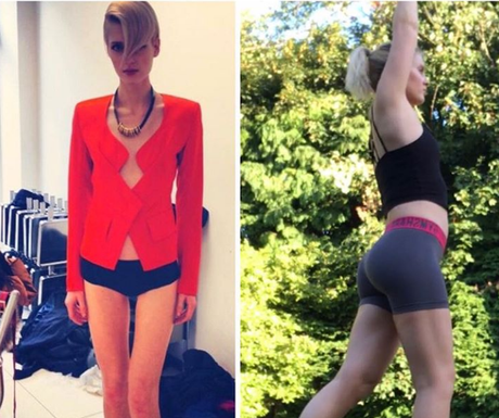 Mira estas 5 hermosas mujeres que superaron la anorexia