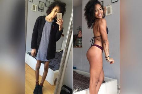 Mira estas 5 hermosas mujeres que superaron la anorexia