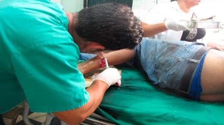 DERRUMBE EN CAIBARIÉN: Hasta el momento 2 muertos y 8 heridos