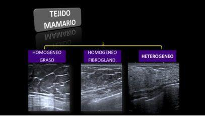 TEJIDO MAMARIO 1.HOMOGENEO GRASO 2. HOMOGENEO FIBROGLANDULAR 3.HETEROGENEO