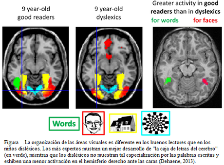 “Breve revisión del estudio de las bases neurobiológicas para explicar la fonología en relación a la conciencia fonológica”, por Paola Vásquez Espinoza