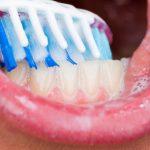 Cuidado bucal durante el tratamiento del cáncer: cómo cuidar la boca y los dientes