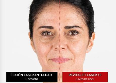 ¿Sesión Láser Anti-Edad o Revitalift Laser X3 de L'Oréal París?