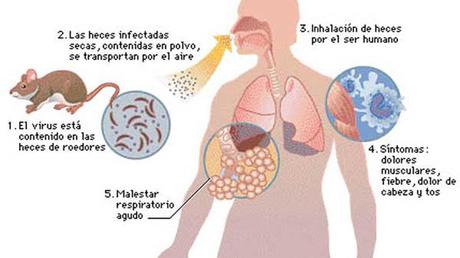 El Cambio Climatico Incrementara las Infecciones por Hantavirus