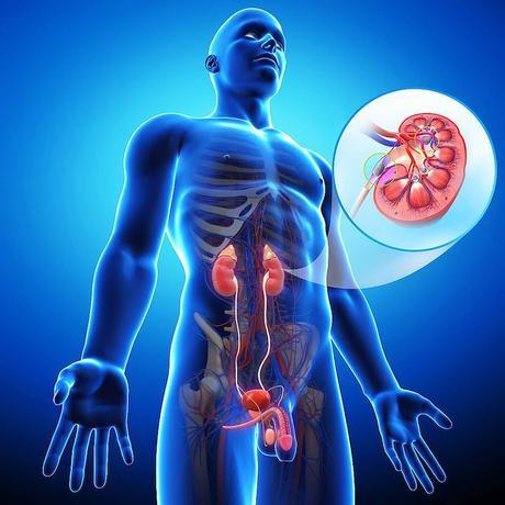 Complicaciones después de la nefrectomía (extirpación renal) Complicaciones después de la nefrectomía (extirpación renal)