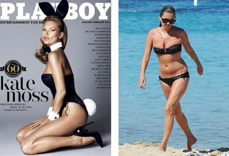 Peores fotos de celebridades en trajes de baño