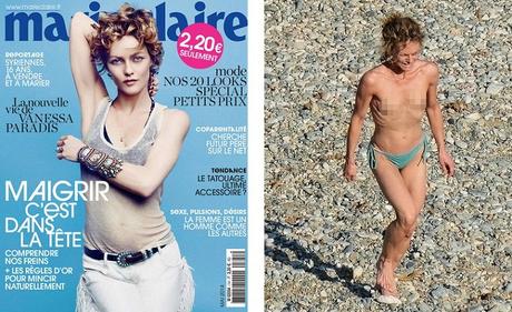 Peores fotos de celebridades en trajes de baño