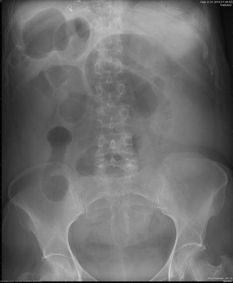 Caso clínico enarm del día