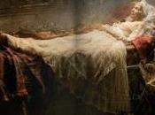 Bella Durmiente tiene amnesia