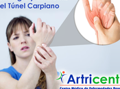 Fibromialgia Síndrome Túnel Carpiano