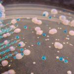 Infecciones recurrentes de levadura: cómo tratar la candidiasis vaginal que vuelve