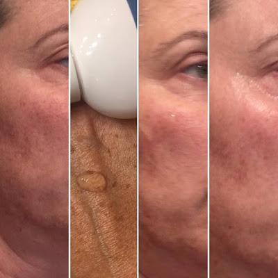 Gel Miscelar, Elisabeth Vargas Cosmetic, rutina limpieza, limpieza facial, cosmetica profesional, alta cosmética, un lujo en tu piel, 