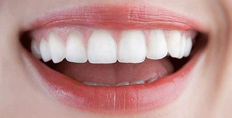 5 básicos para lucir una sonrisa blanca este verano