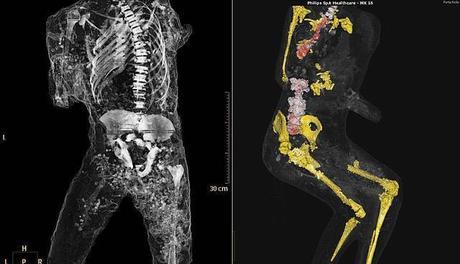 Las tomografías revelan órganos en perfecto estado
