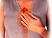 ¿Qué Reflujo Ácido?