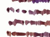 obra Mirtha Dermisache despliega MALBA