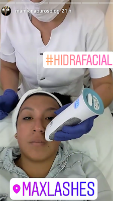 Hidrafacial: desintoxica e hidrata tu piel