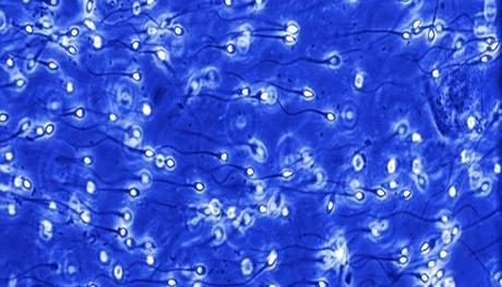 ¿Nadadores sanos o barco a la deriva? 8 Muestras de semen sano y cómo reconocer el esperma anormal