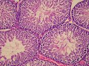 Macrofagos Testiculares Determinan Fertilidad Masculina