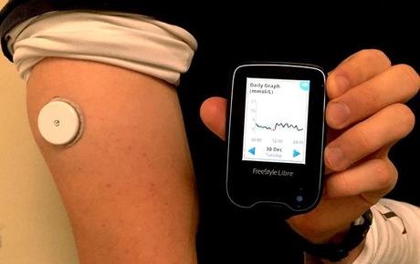 Un nuevo dispositivo evita los pinchazos para medir la glucosa en diabéticos.