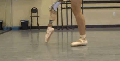 Chica de 15 años perdió su pierna pero sigue bailando un caso de Motivacion increible