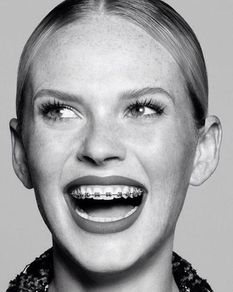 El Cuidado De Tus Dientes: Ortodoncia Invisible vs Brackets