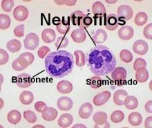 Una Mala utilización de los Antibióticos incrementa las Infecciones