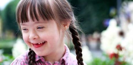 EXTERMINIO DE LOS SÍNDROME DE DOWN