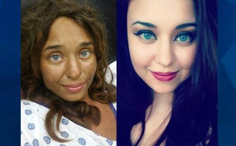 Muchacha sobrevive casi un mes perdida en un bosque