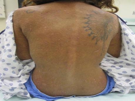 Muchacha sobrevive casi un mes perdida en un bosque