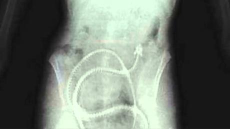 3 dietas muy peligrosas que perjudican seriamente la salud